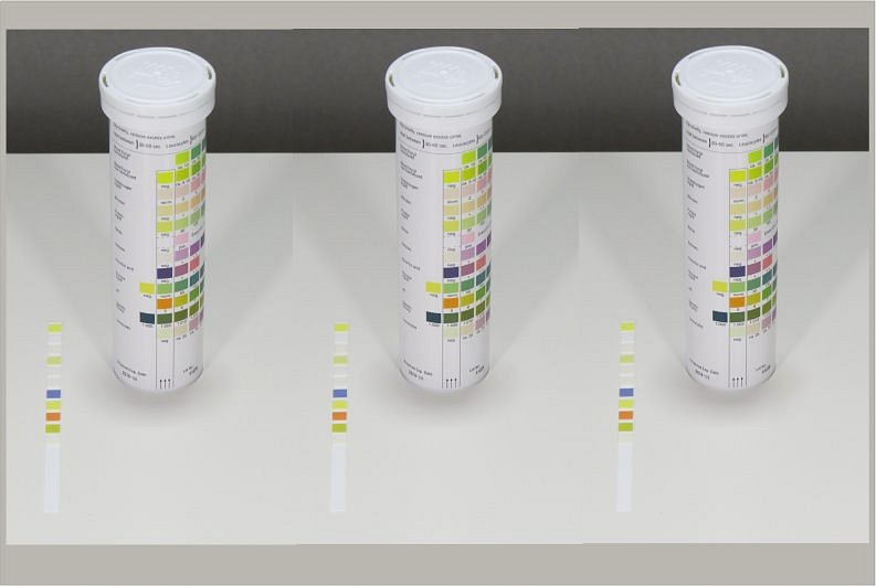 Difference Between Hemolyzed And Non Hemolyzed Blood In Urine 50+ Pages